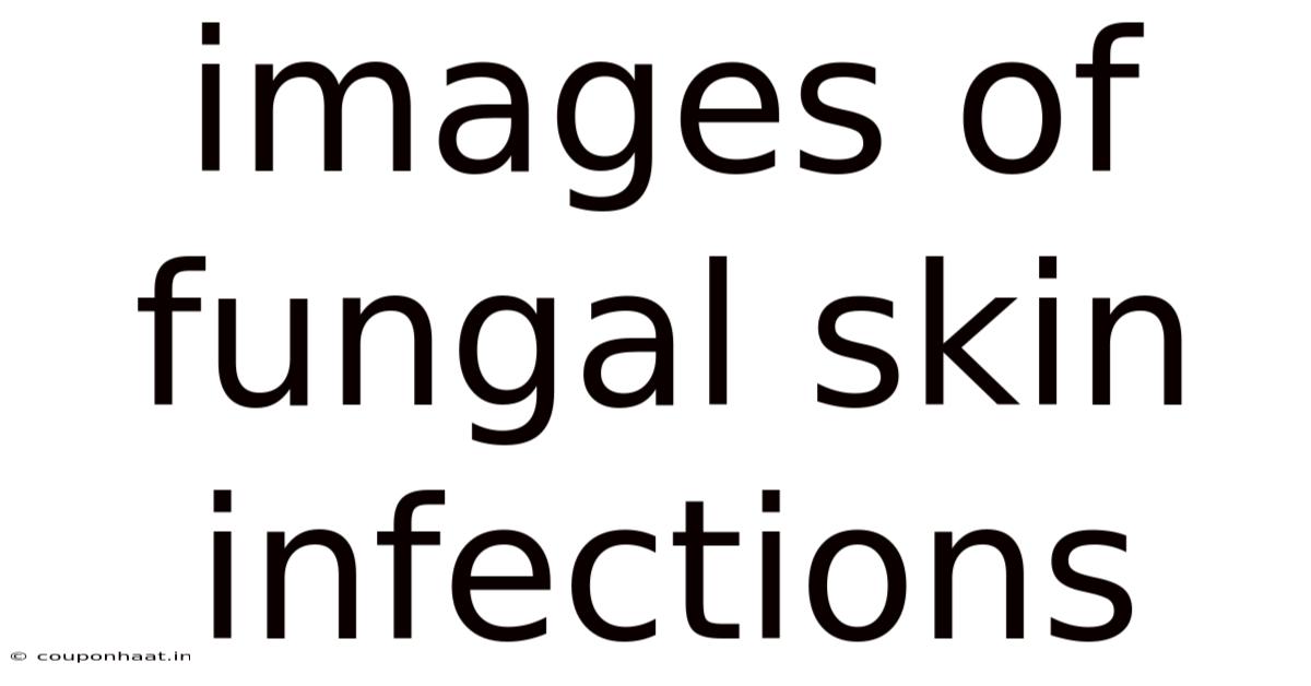 Images Of Fungal Skin Infections